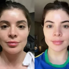 Após lábios, Gkay retira preenchimento no rosto
