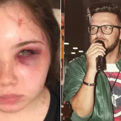 Filha do cantor sertanejo denuncia o pai de agressão e mostra hematomas