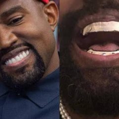 Kanye West substitui os dentes por próteses de titânio de R$4 milhões