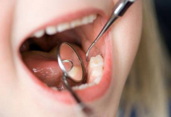 odontologia-infantil-divulgação