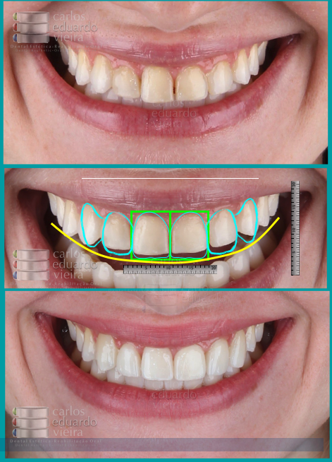 Crédito: Divulgação/Instituto Tavares Vieira
