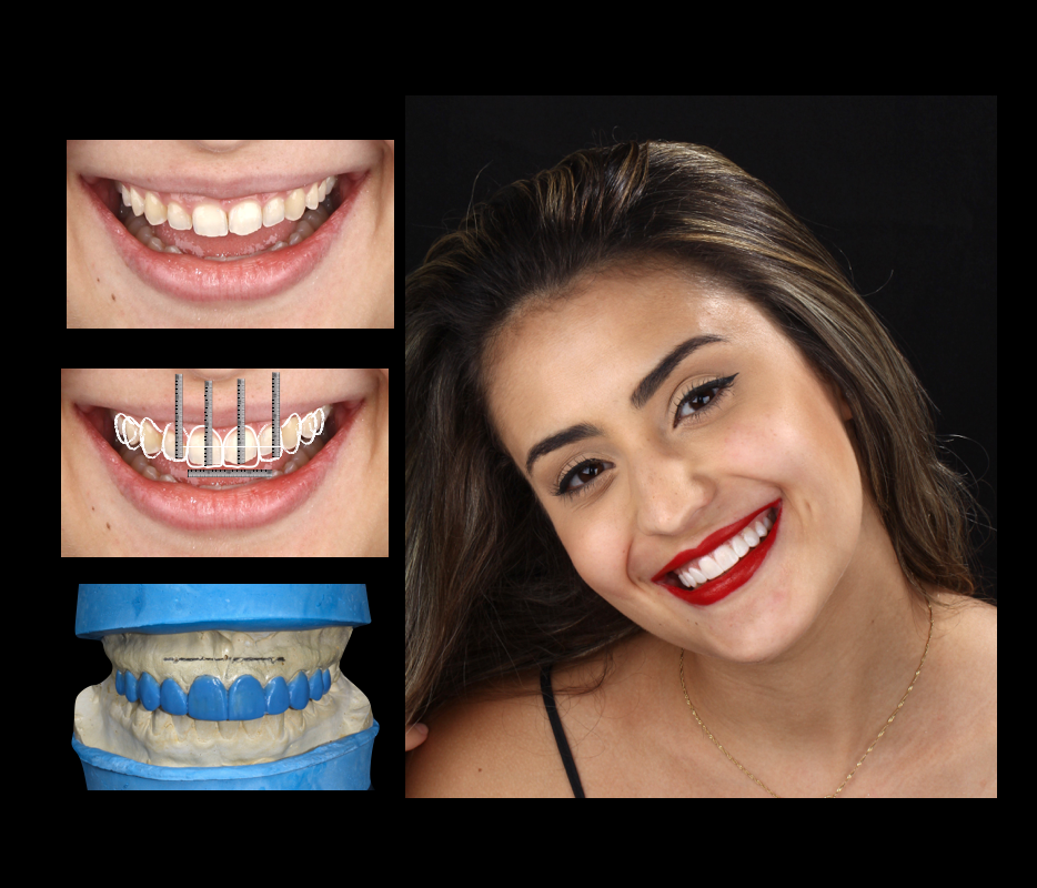 Crédito: Divulgação/Instituto Tavares Vieira