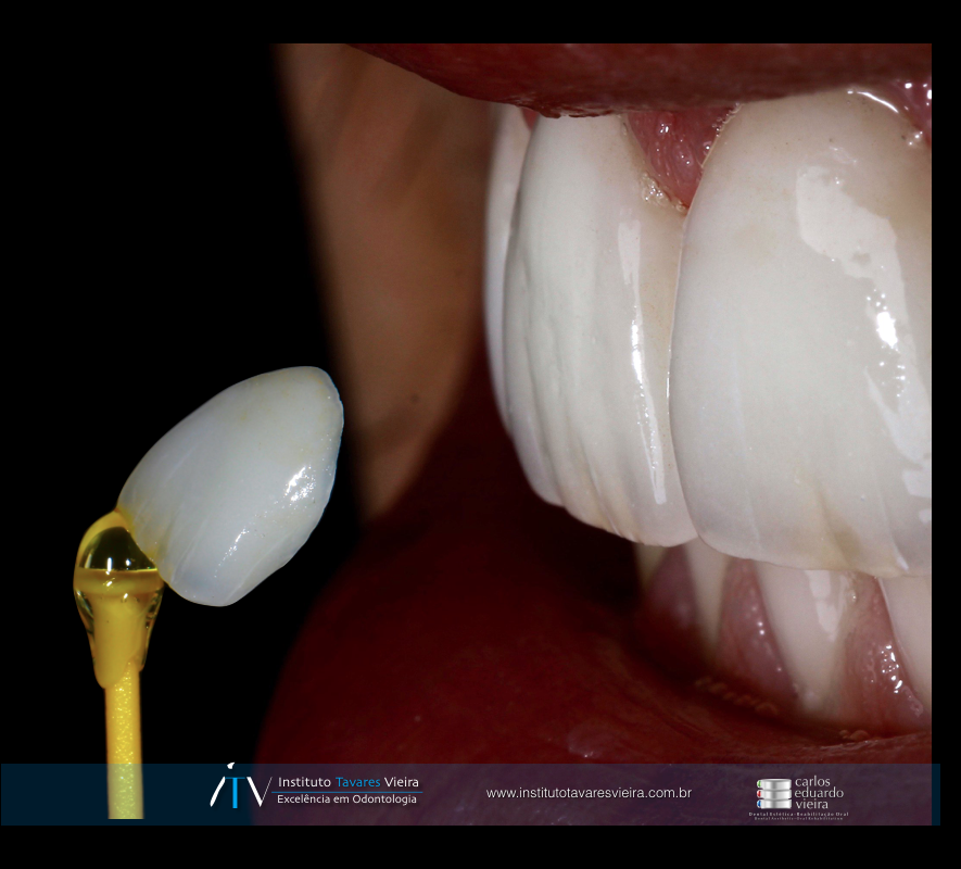 Crédito: Divulgação/Instituto Tavares Vieira