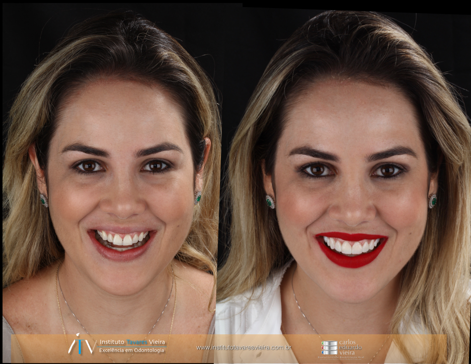 Crédito: Divulgação/Instituto Tavares Vieira