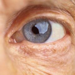 Oftalmos promovem ação social para idosos na praia de Boa Viagem