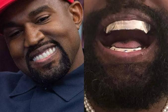Kanye West substitui os dentes por próteses de titânio de R$4 milhões